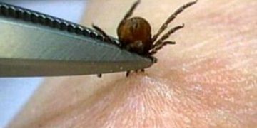 Atenţie la CĂPUŞE! Un copil a paralizat parţial după ce a fost mușcat de o căpușă