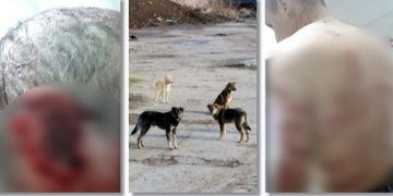 Un bărbat a ajuns în stare gravă la spital, muşcat de o haită de câini