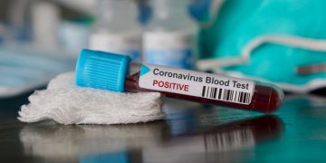 Coronavirus: Numărul deceselor a ajuns la 78