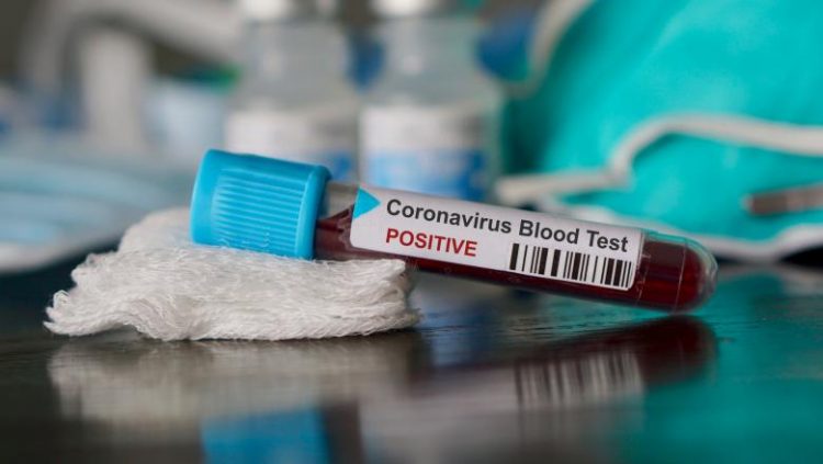 Coronavirus: Numărul deceselor a ajuns la 78