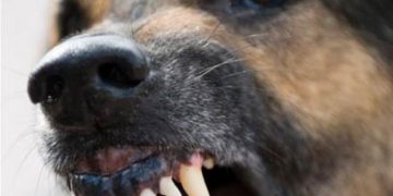 Un copil de 6 ani și bunica lui, atacaţi de doi câini agresivi în timp ce se plimbau pe stradă